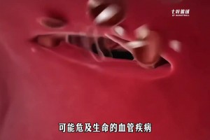 血栓痊愈后到少林寺修行 文班亚马仿佛打通了任督二脉！
